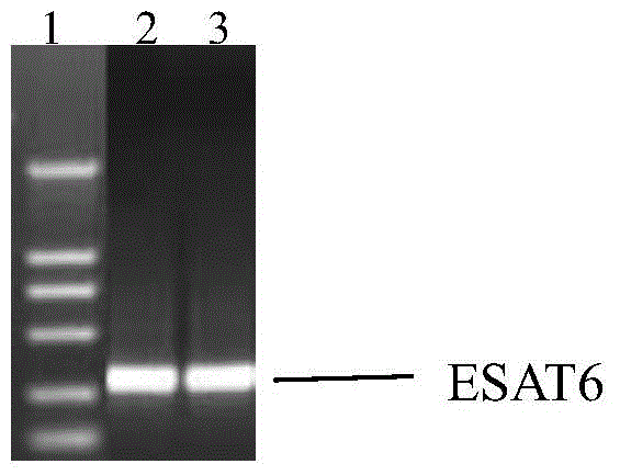 Therapeutic mycobacterium tuberculosis DNA vaccine and preparation method and application thereof