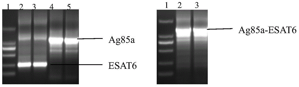 Therapeutic mycobacterium tuberculosis DNA vaccine and preparation method and application thereof