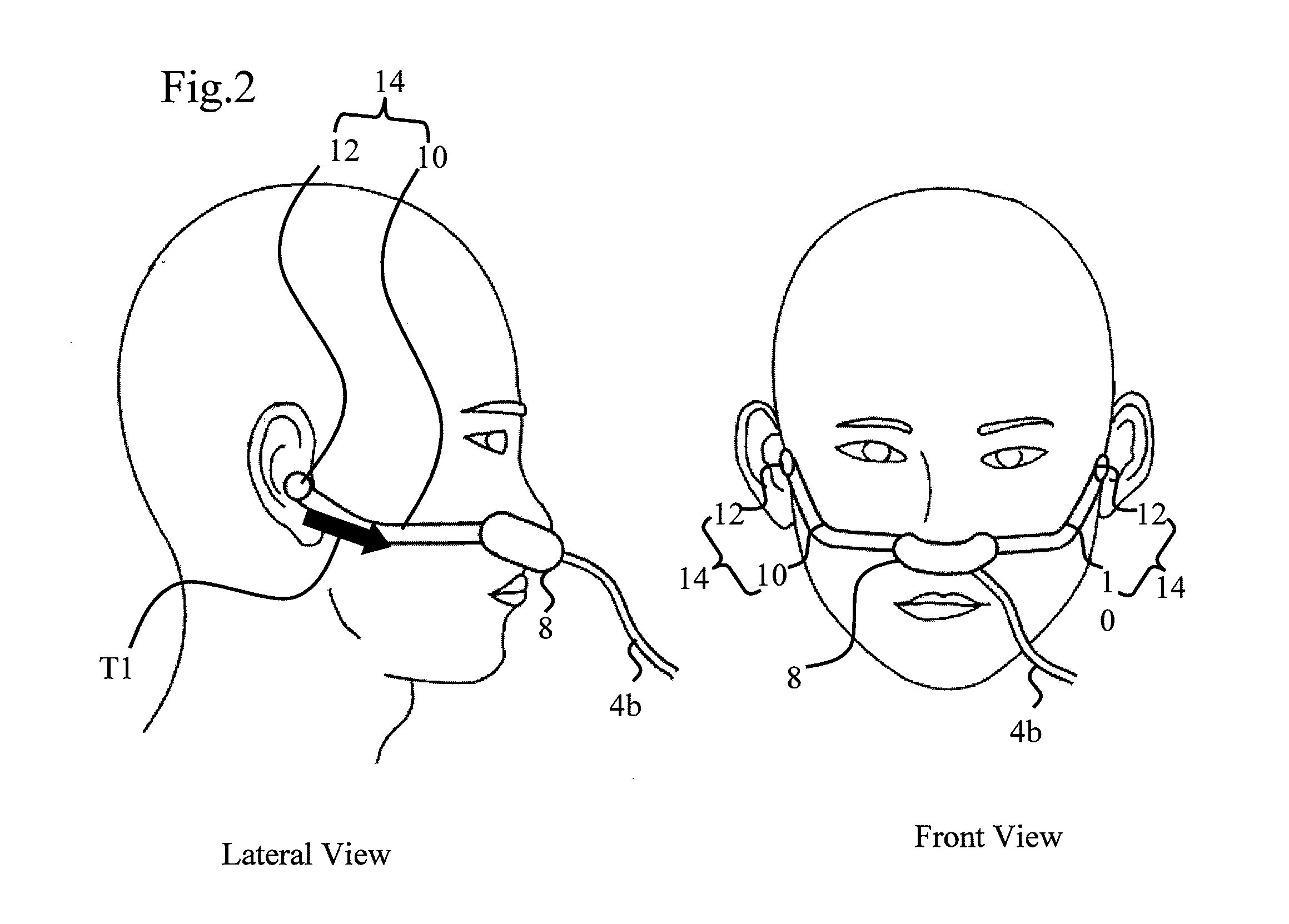 Wearing tool for breathing mask, and breathing mask