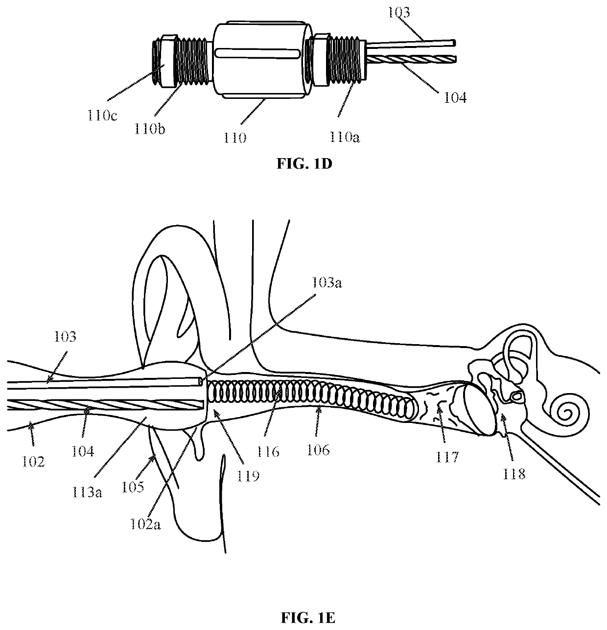 Ears Disimpactor