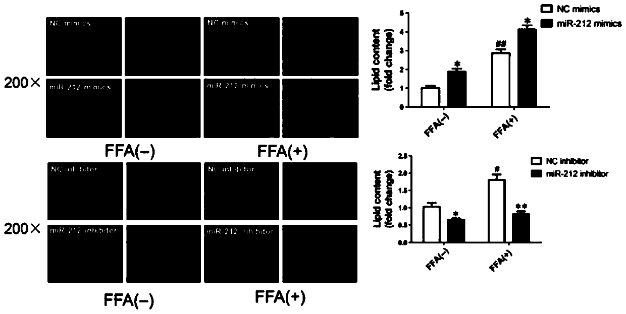 Construction and application of microRNA-212-3P sponge based on recombinant adeno-associated virus 8