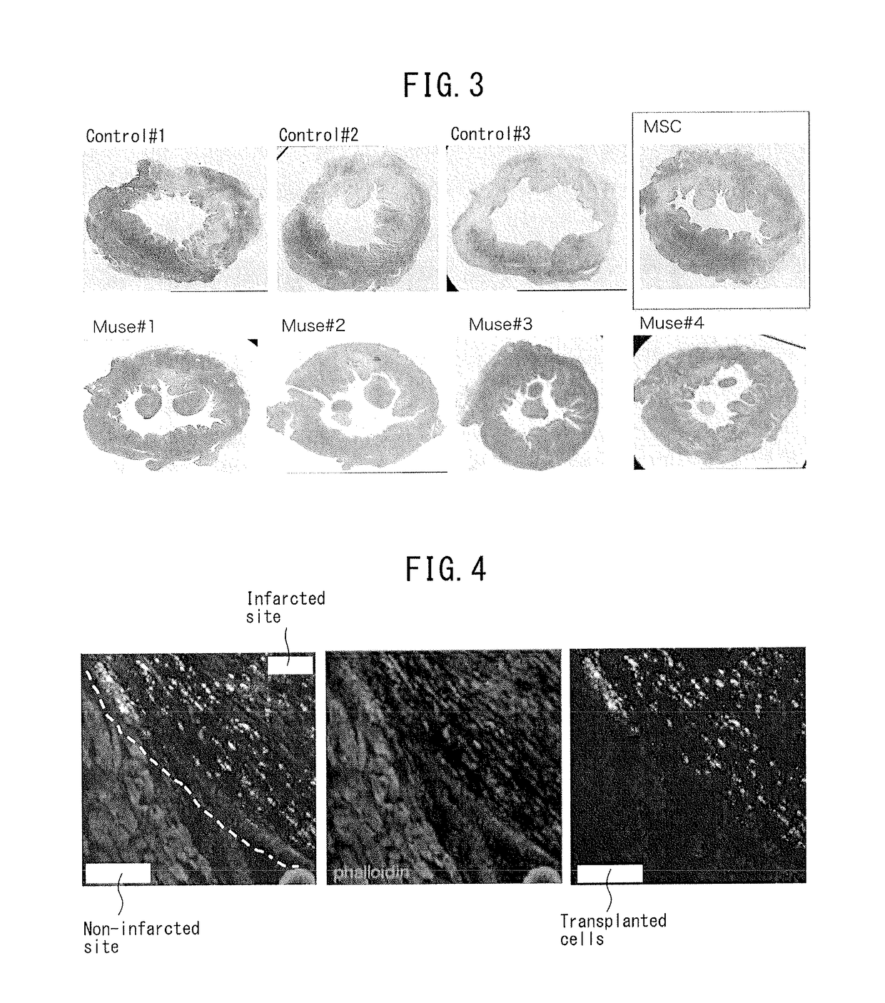 Pluripotent stem cell that induces repair and regeneration after myocardial infarction