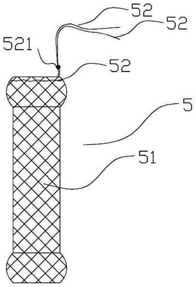 An anti-displacement esophageal stent kit