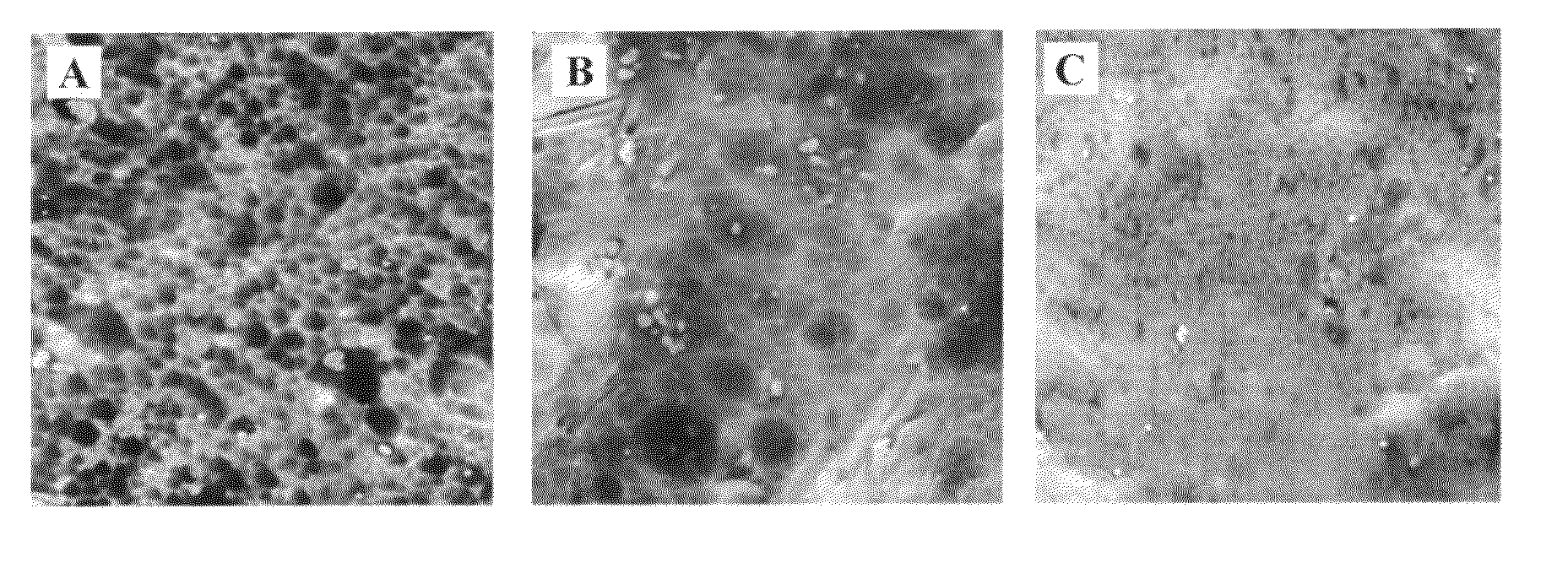 Method of surface treatment of aluminum foil and its alloy and method of producing immobilized nanocatalyst of transition metal oxides and their alloys