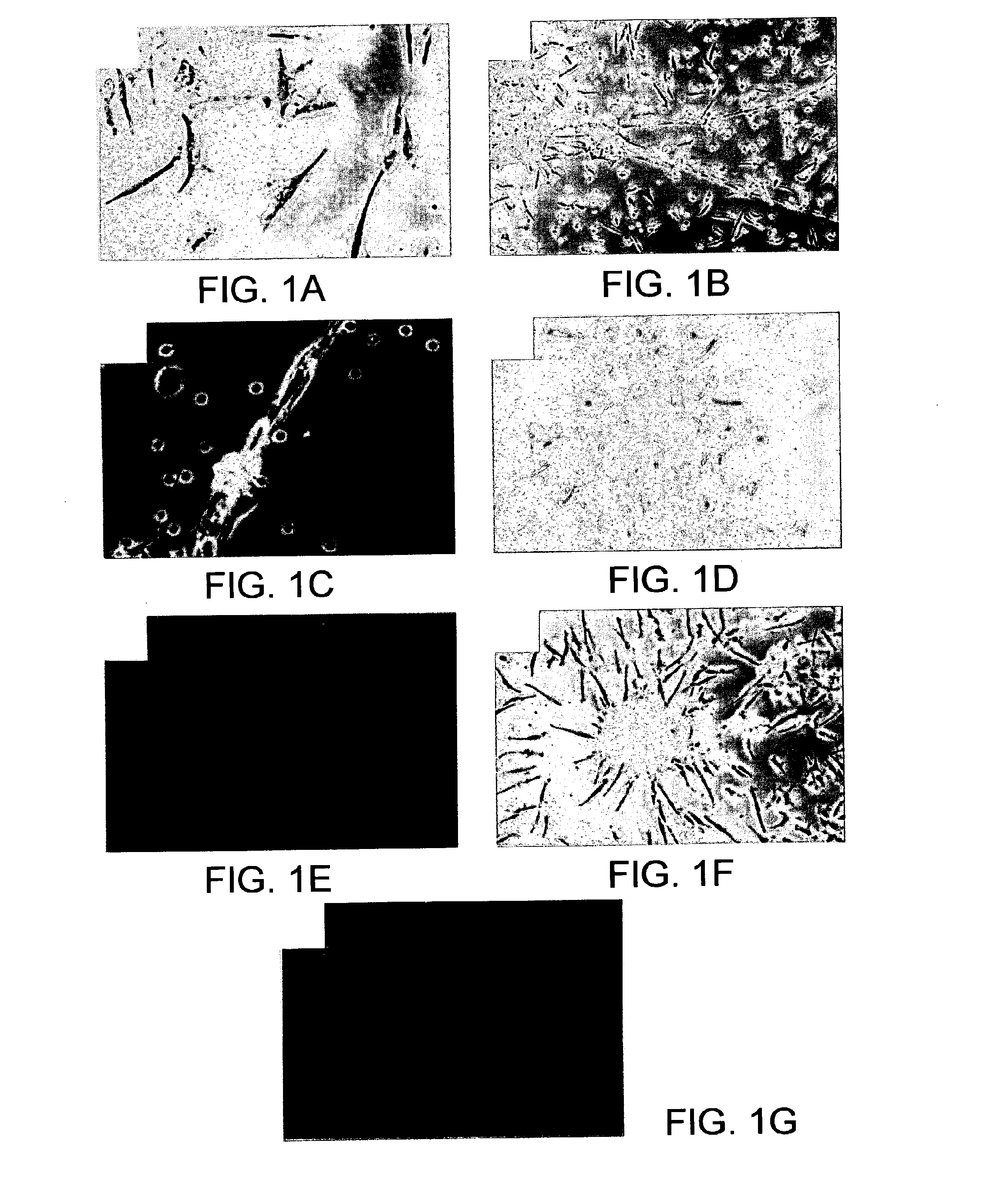 Compositions and methods for regulating angiogenesis