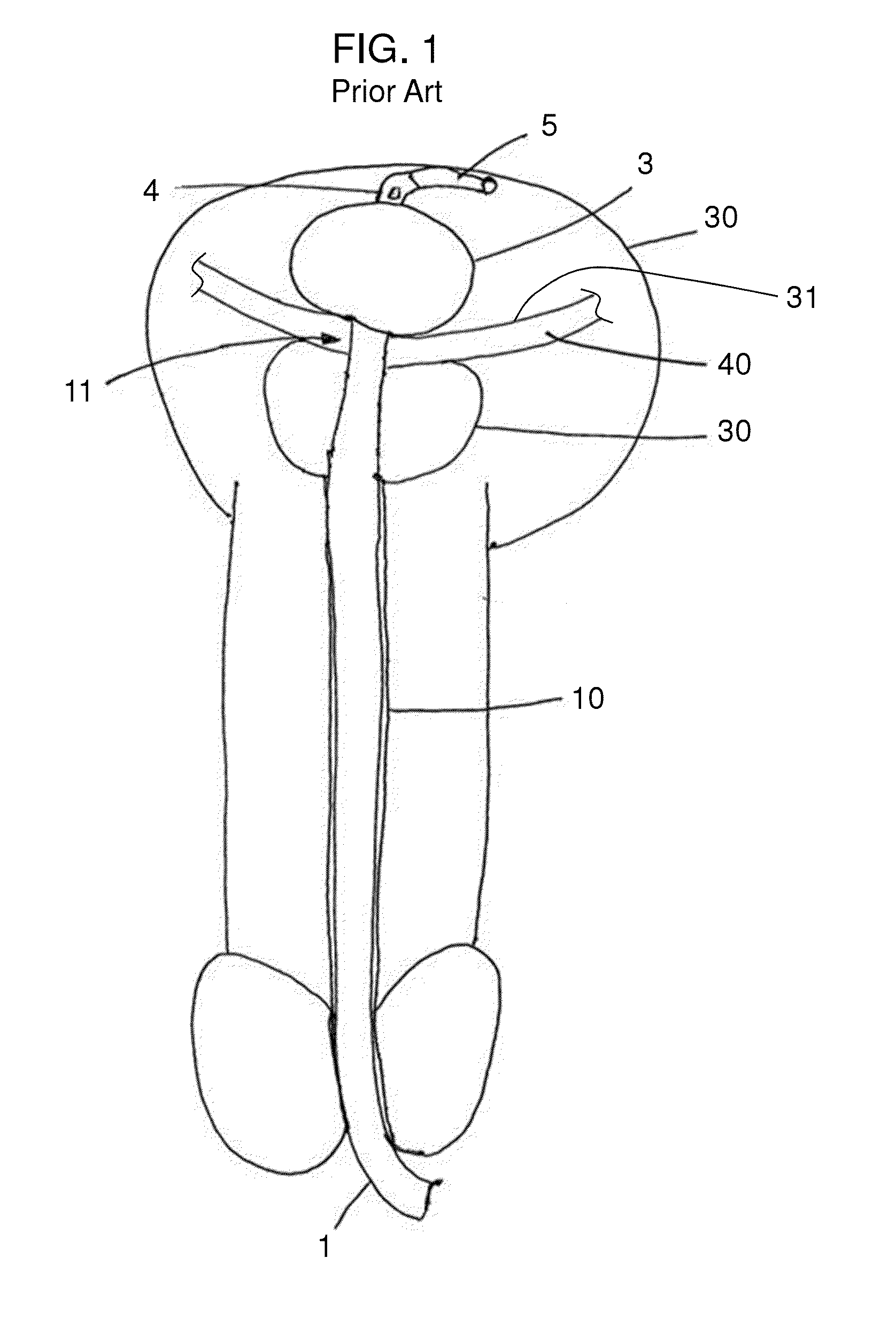 Stretch Valve Balloon Catheter and Methods for Producing and Using Same