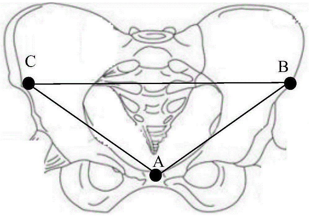 Method and system for acquiring pelvis posture in total hip replacement operation