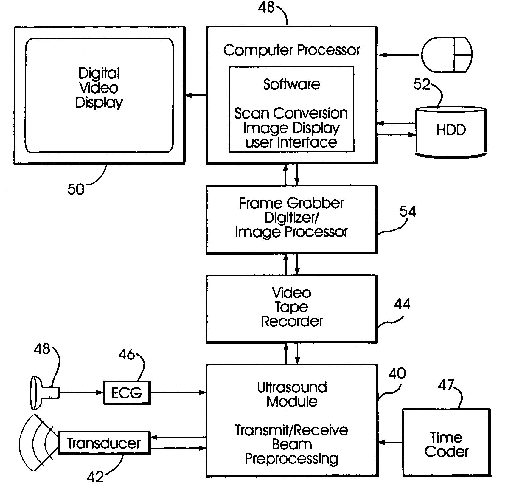 System and method for improving ultrasound image acquisition and replication for repeatable measurements of vascular structures