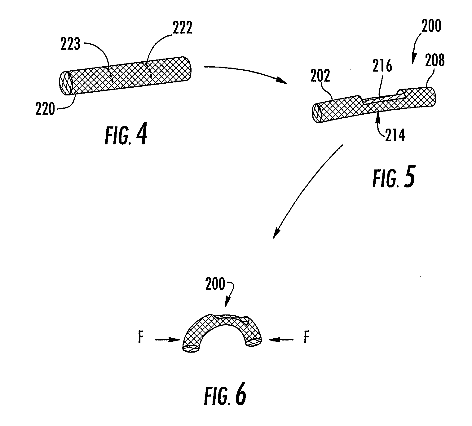 Stent graft having extended landing area and method for using the same