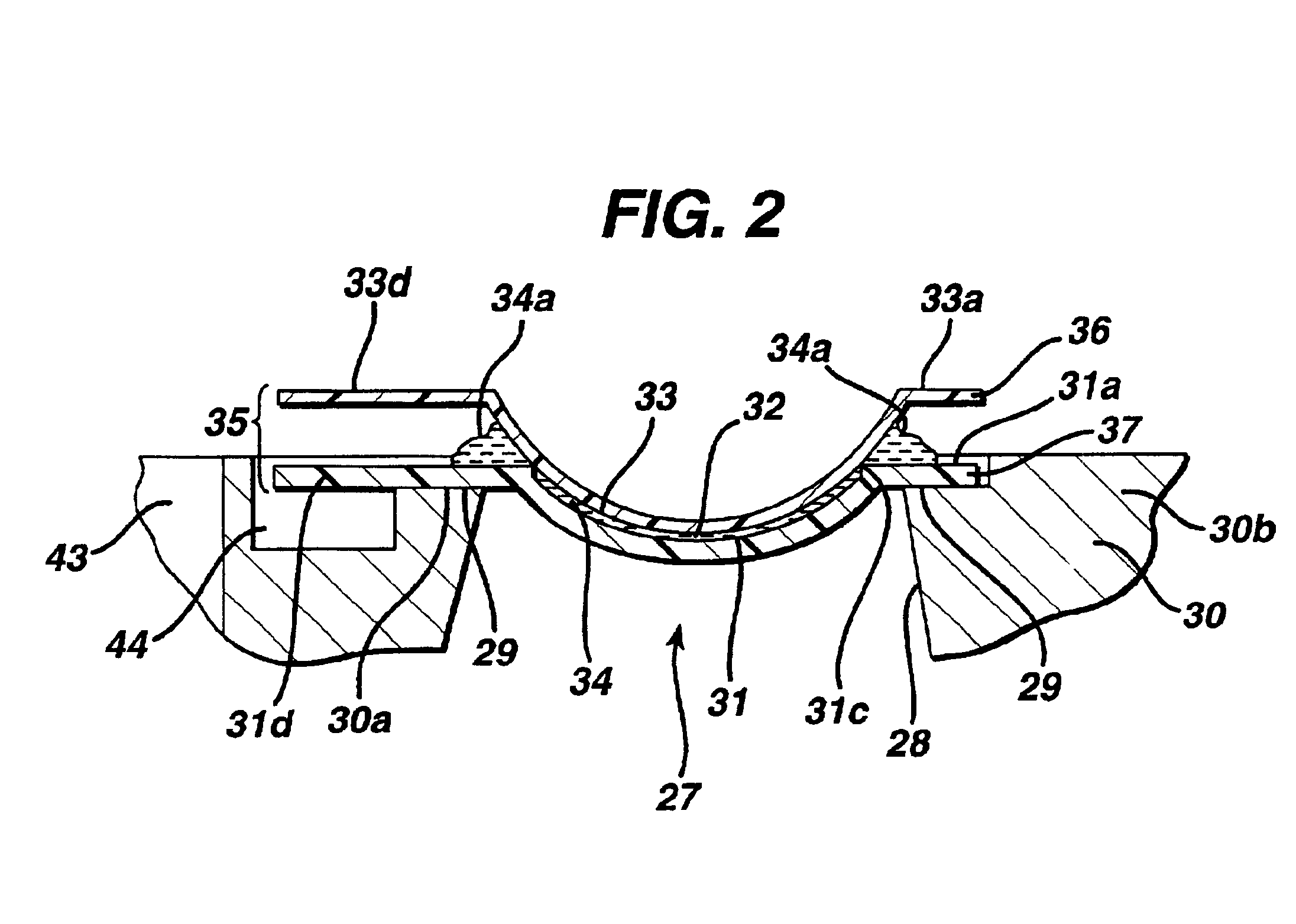 Method and apparatus for contact lens mold assembly
