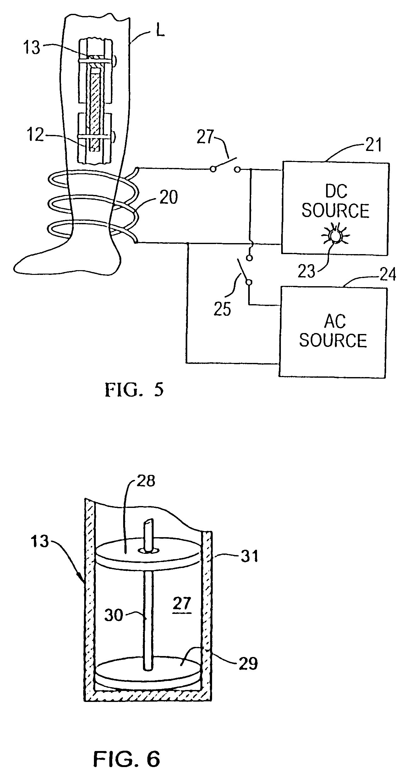 Magnetically-actuable intramedullary device