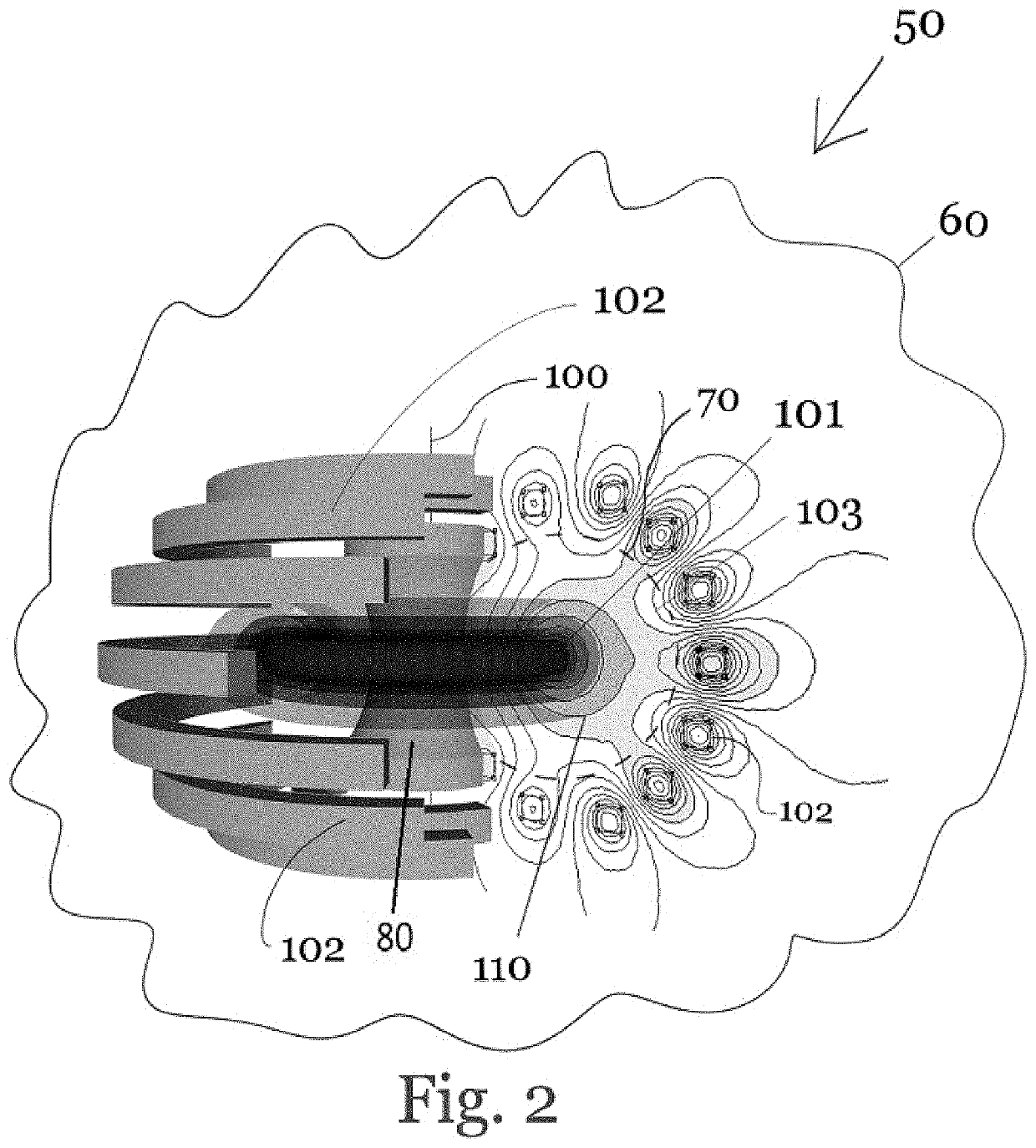 Plasma Confinement Device with Helical Current and Fluid Flow