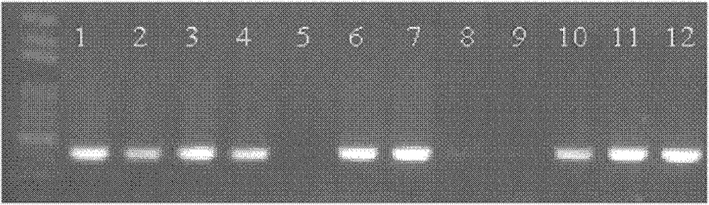 Soybean folic acid synthesis key enzyme ADCS and gene and application thereof
