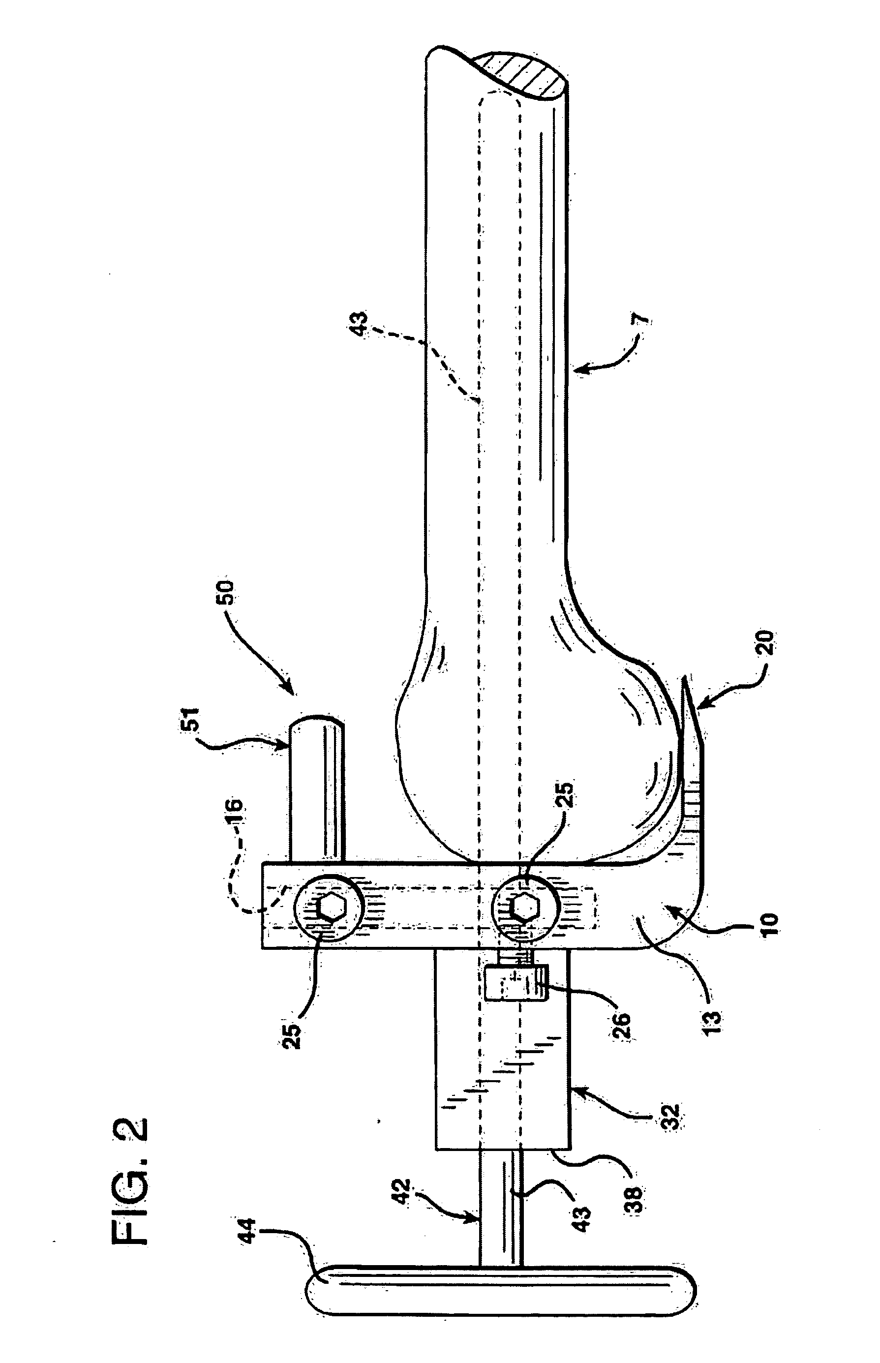 Methods and apparatus for femoral and tibial resection