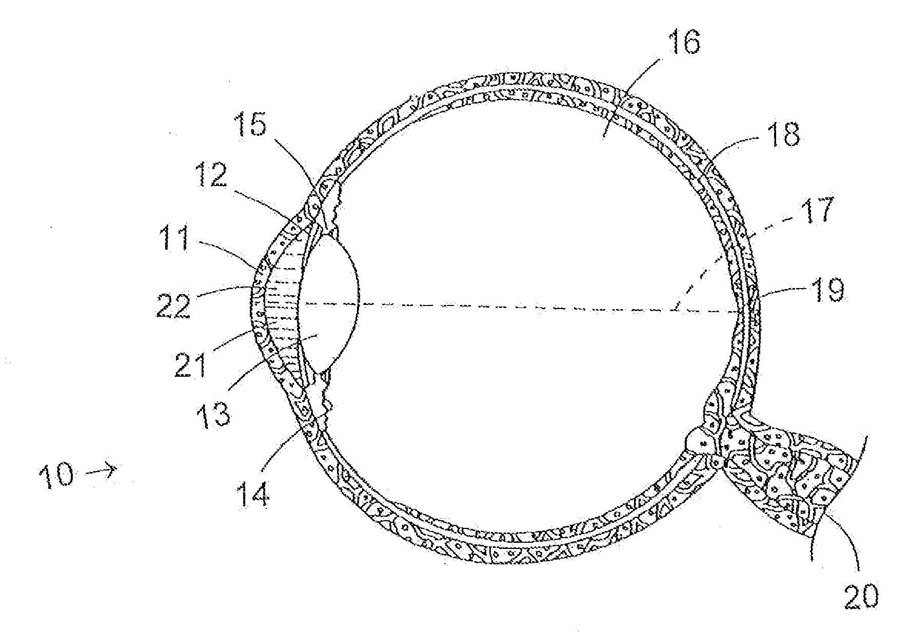 Methods and patterns for increasing amplitude of accommodations in a human lens