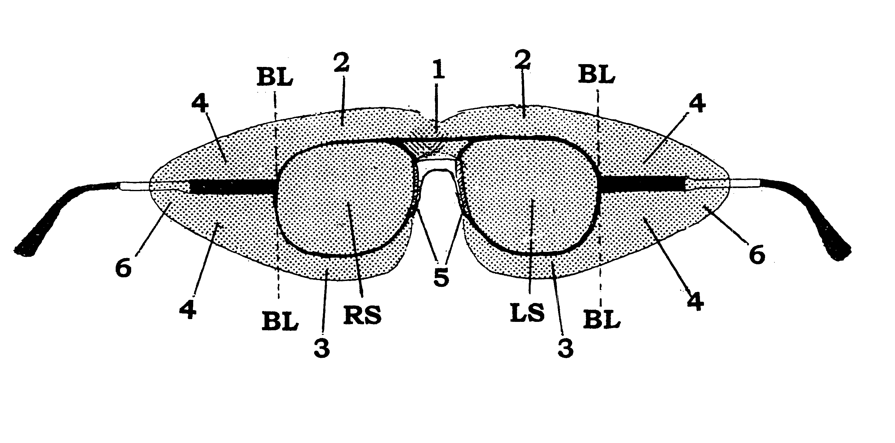 Temporary, disposable glare shield for eyeglasses