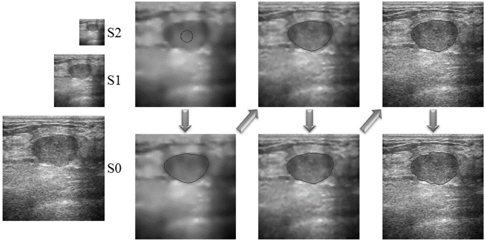 Ultrasound image segmentation method and system