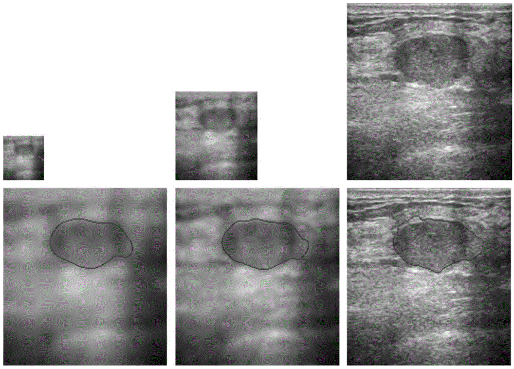 Ultrasound image segmentation method and system