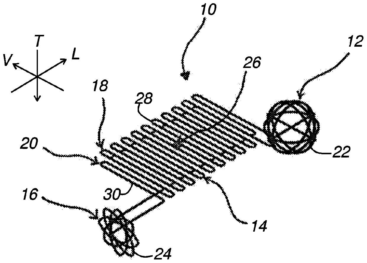 Implant for medical use intended to clip to a biological protuberance