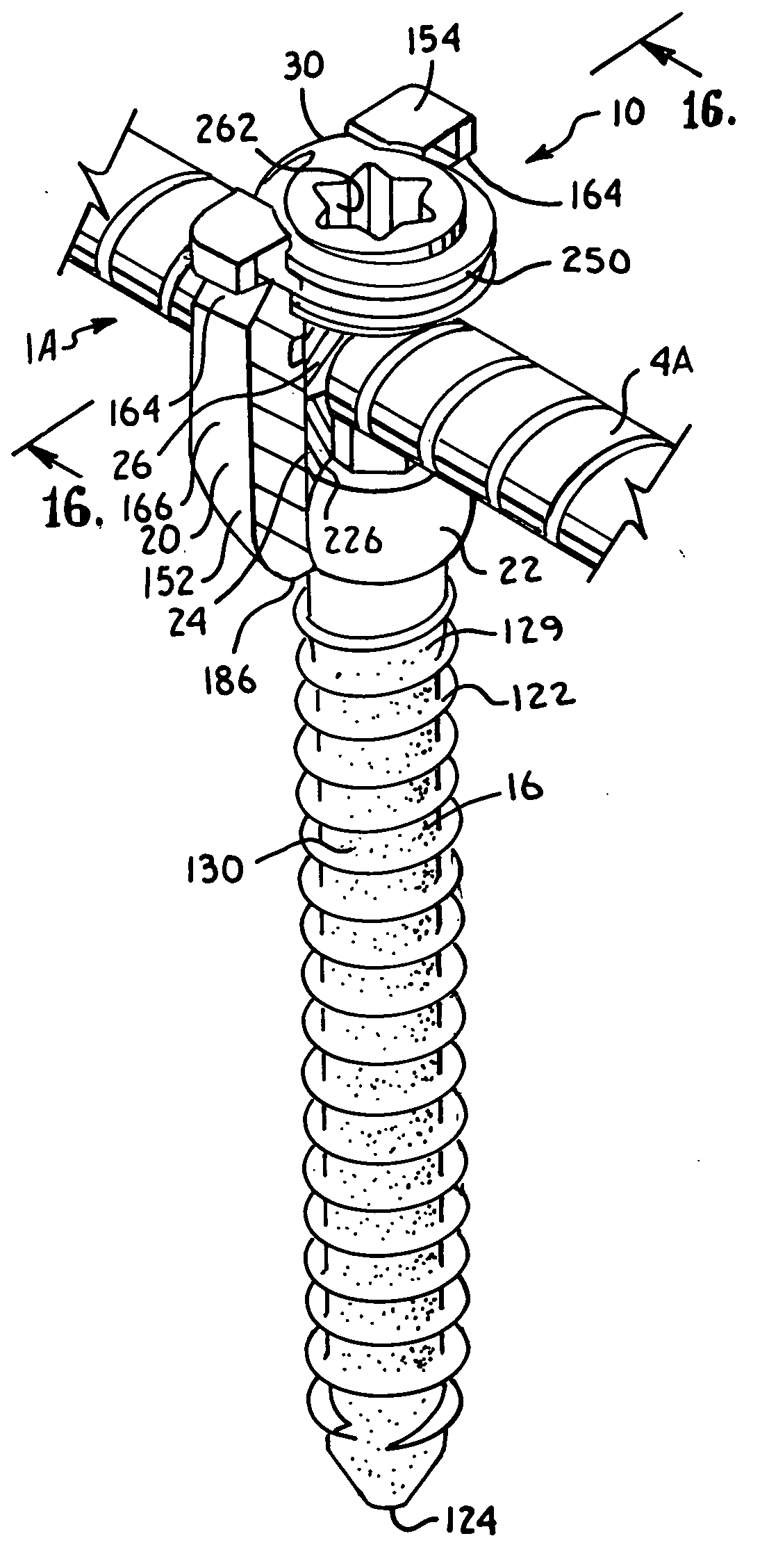 Dynamic fixation assemblies with inner core and outer coil-like member