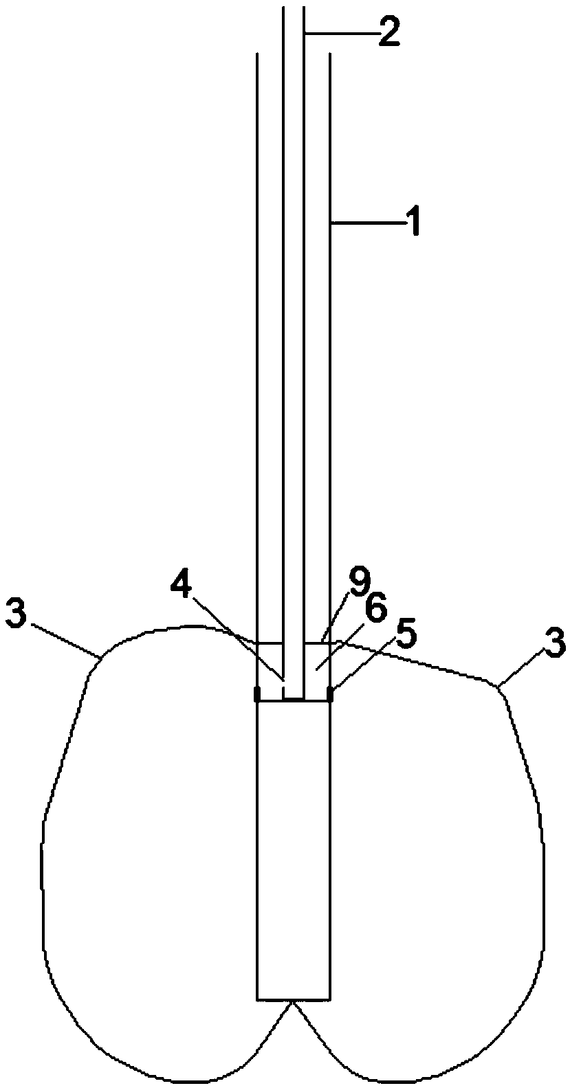 Grouting bag type end-enlarged anchor rod for tunnel rectification and use method