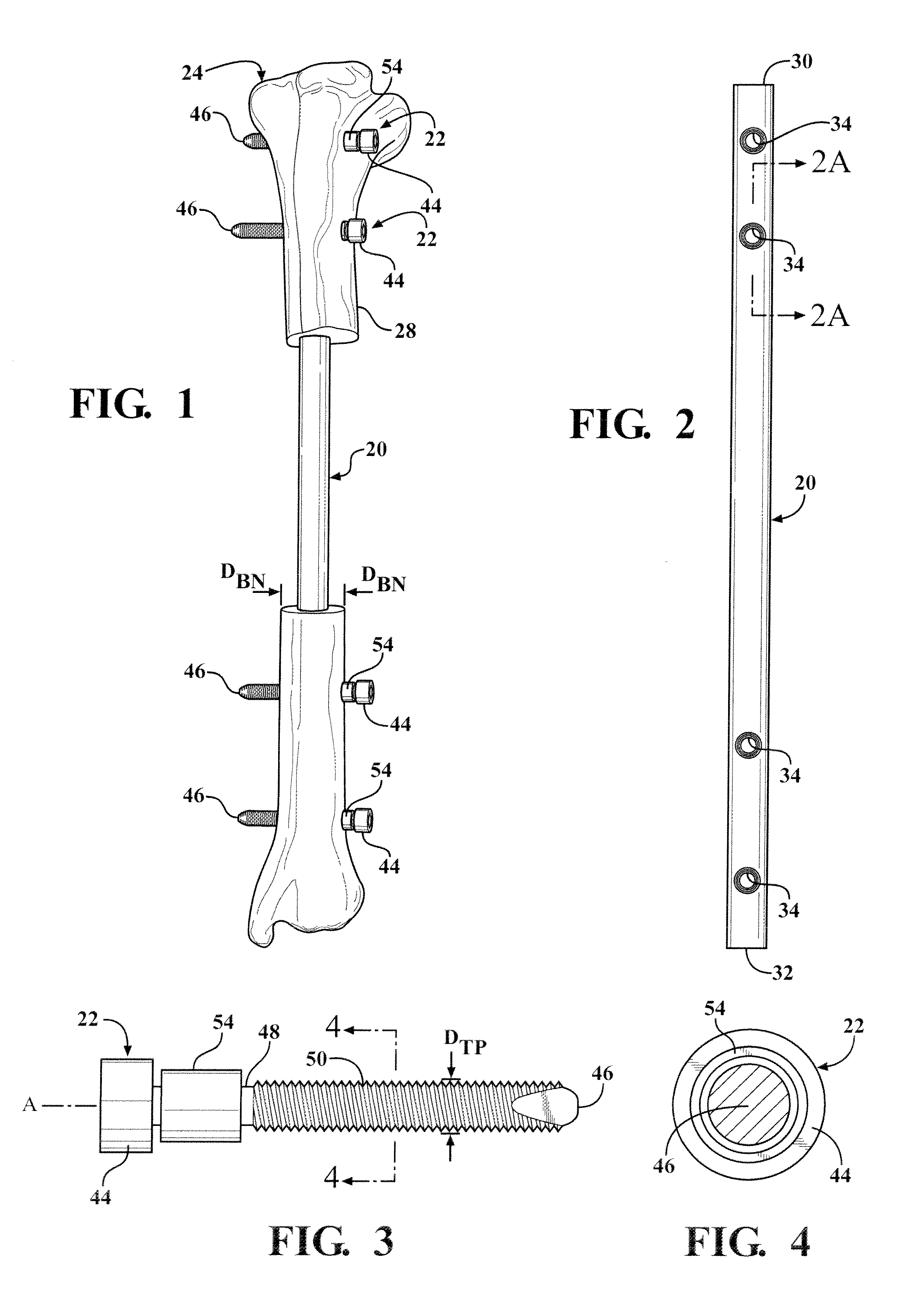 Easily Implantable And Stable Nail-Fastener For Skeletal Fixation And Method