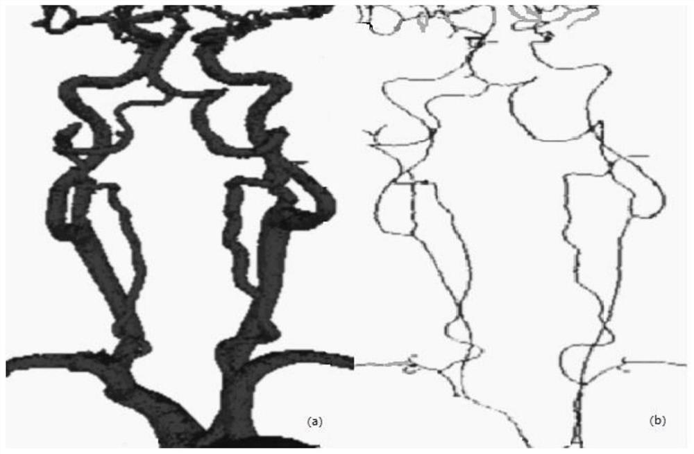 A method and device for excision of adhesions based on blood vessel centerline