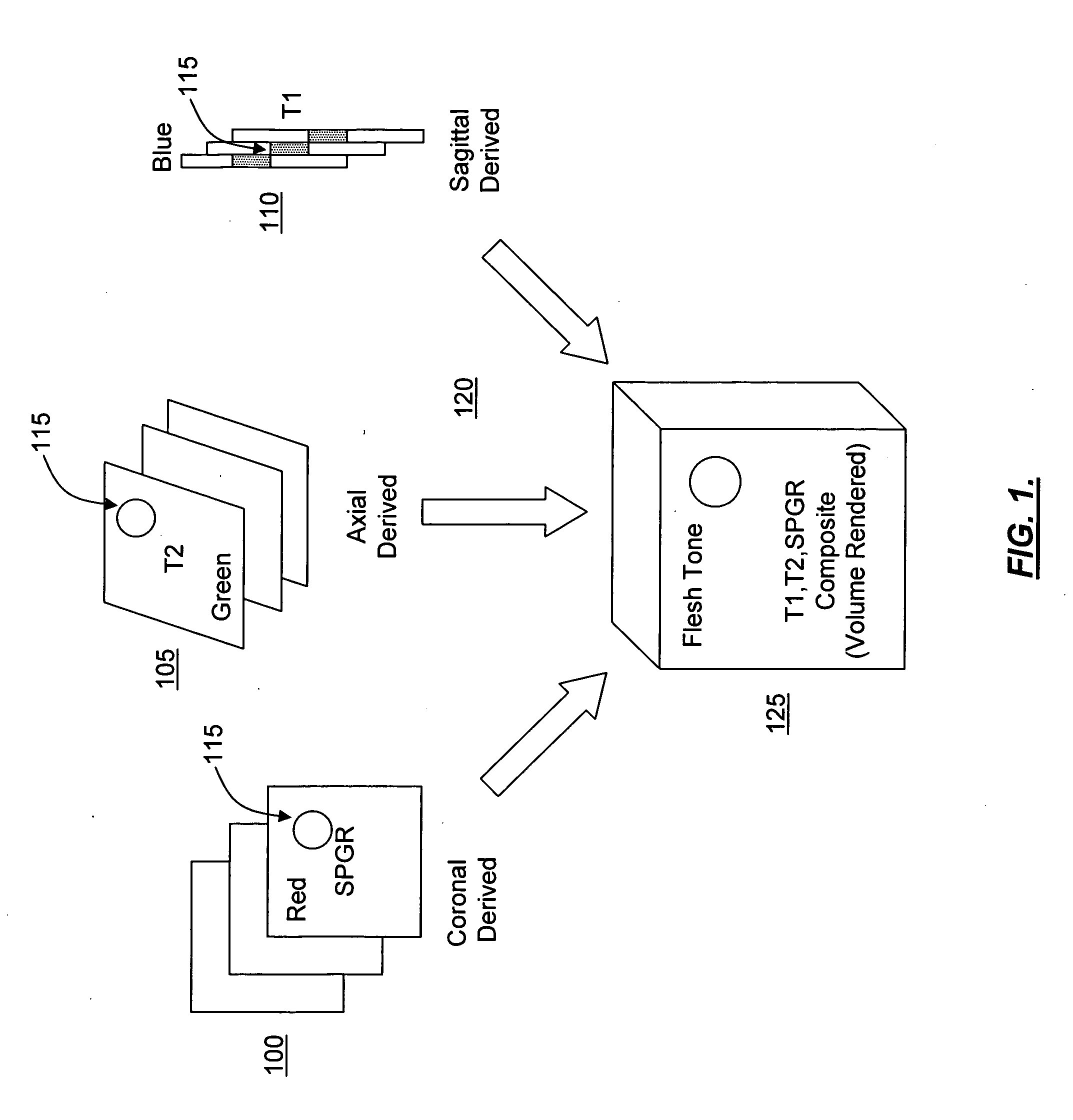Opposed orthogonal fusion system and method for generating color segmented MRI voxel matrices