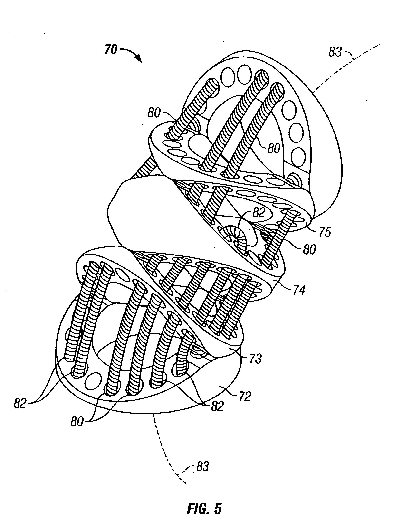 Surgical tool having positively positionable tendon-actuated multi-disk wrist joint