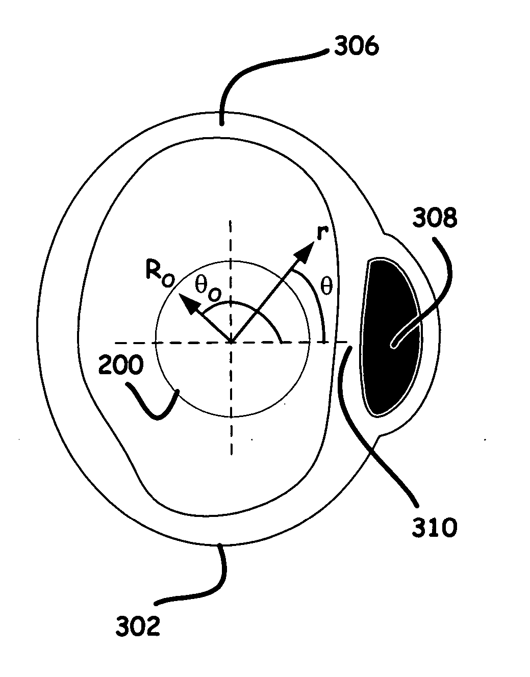 Radial reflection diffraction tomography