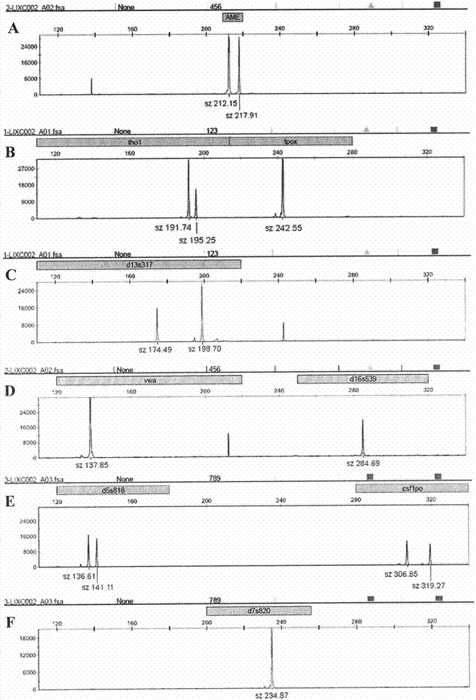 Human hepatoma carcinoma cell line and application thereof