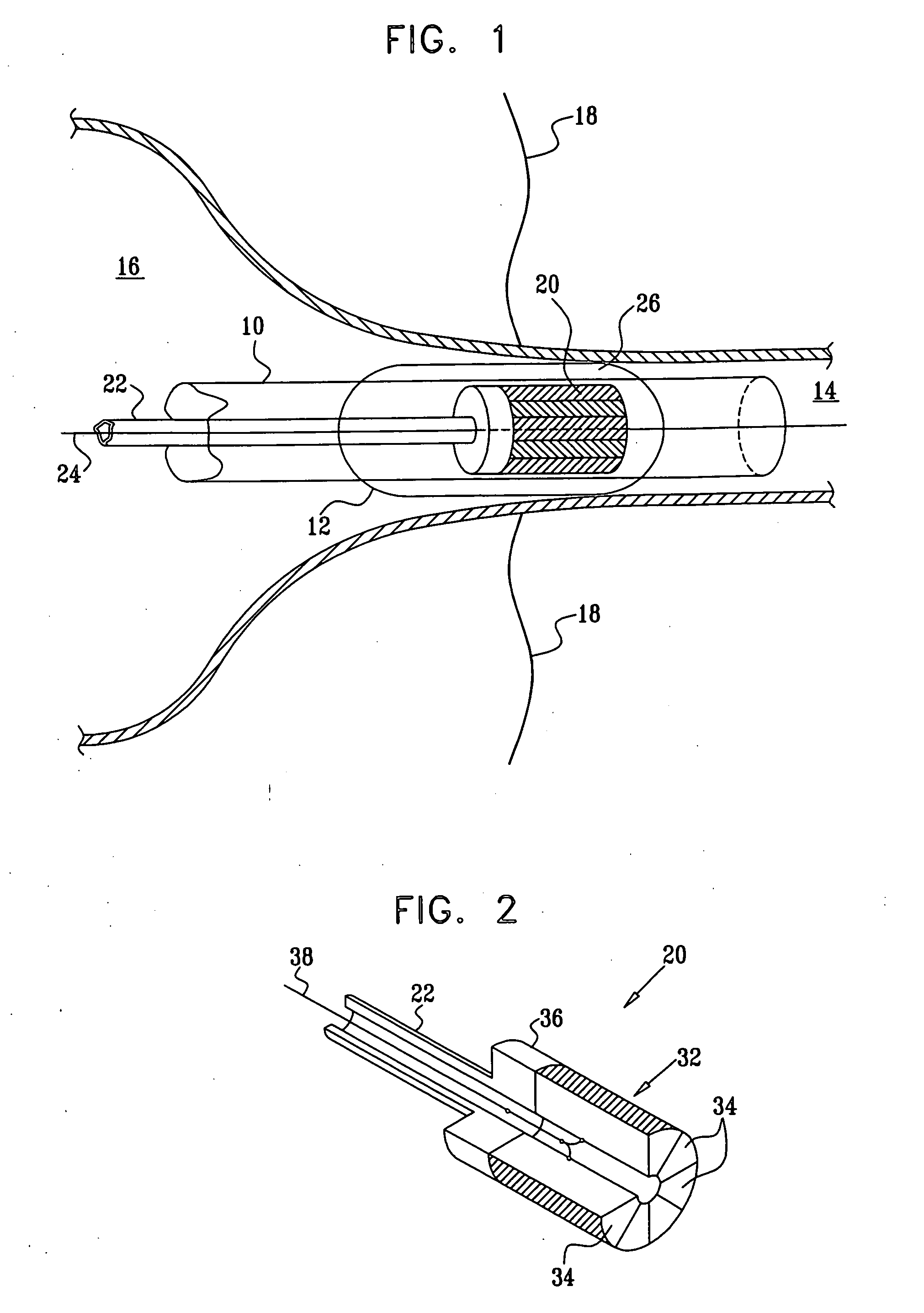 Phased-array for tissue treatment