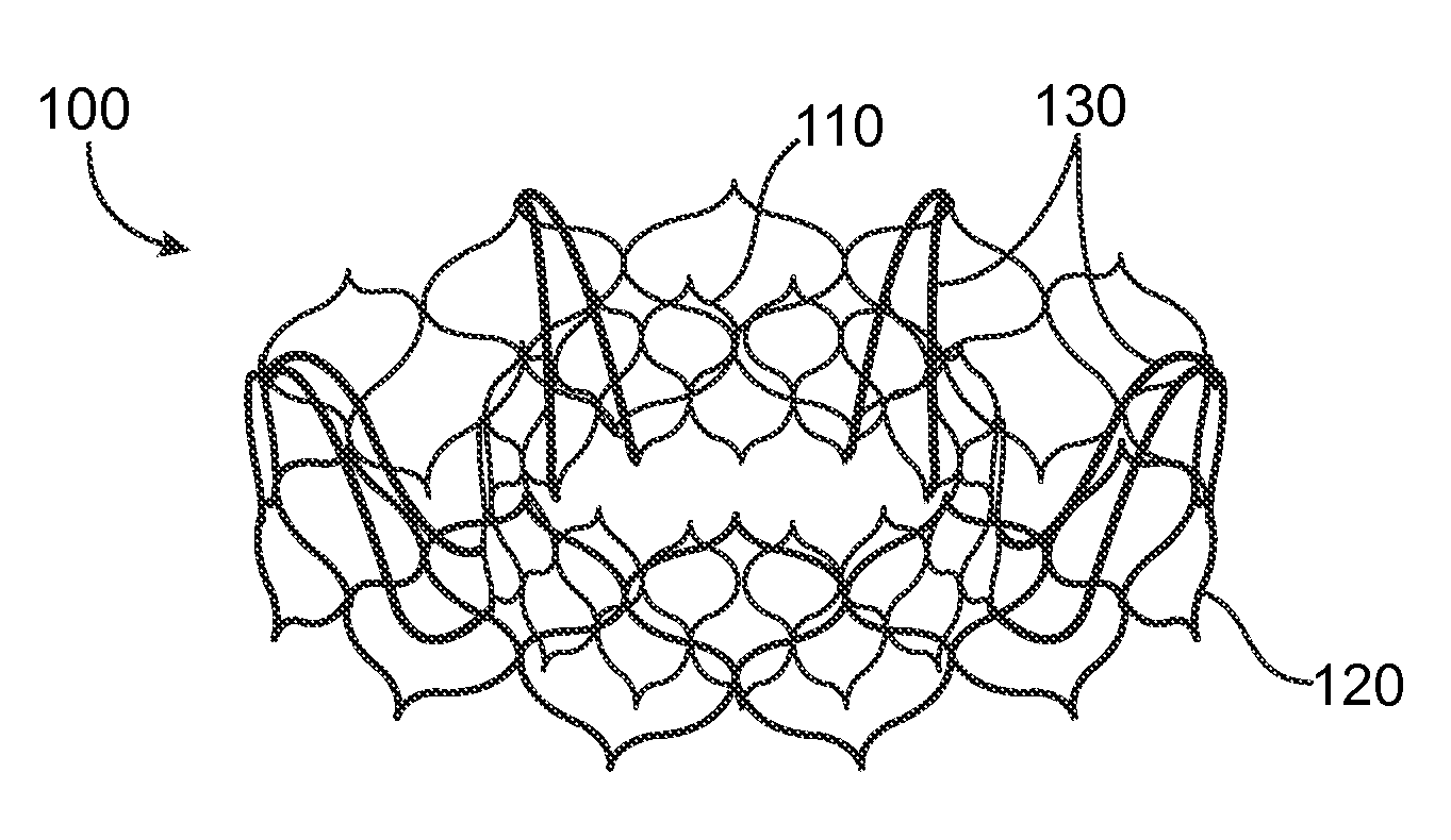 Valve prosthesis and method for delivery