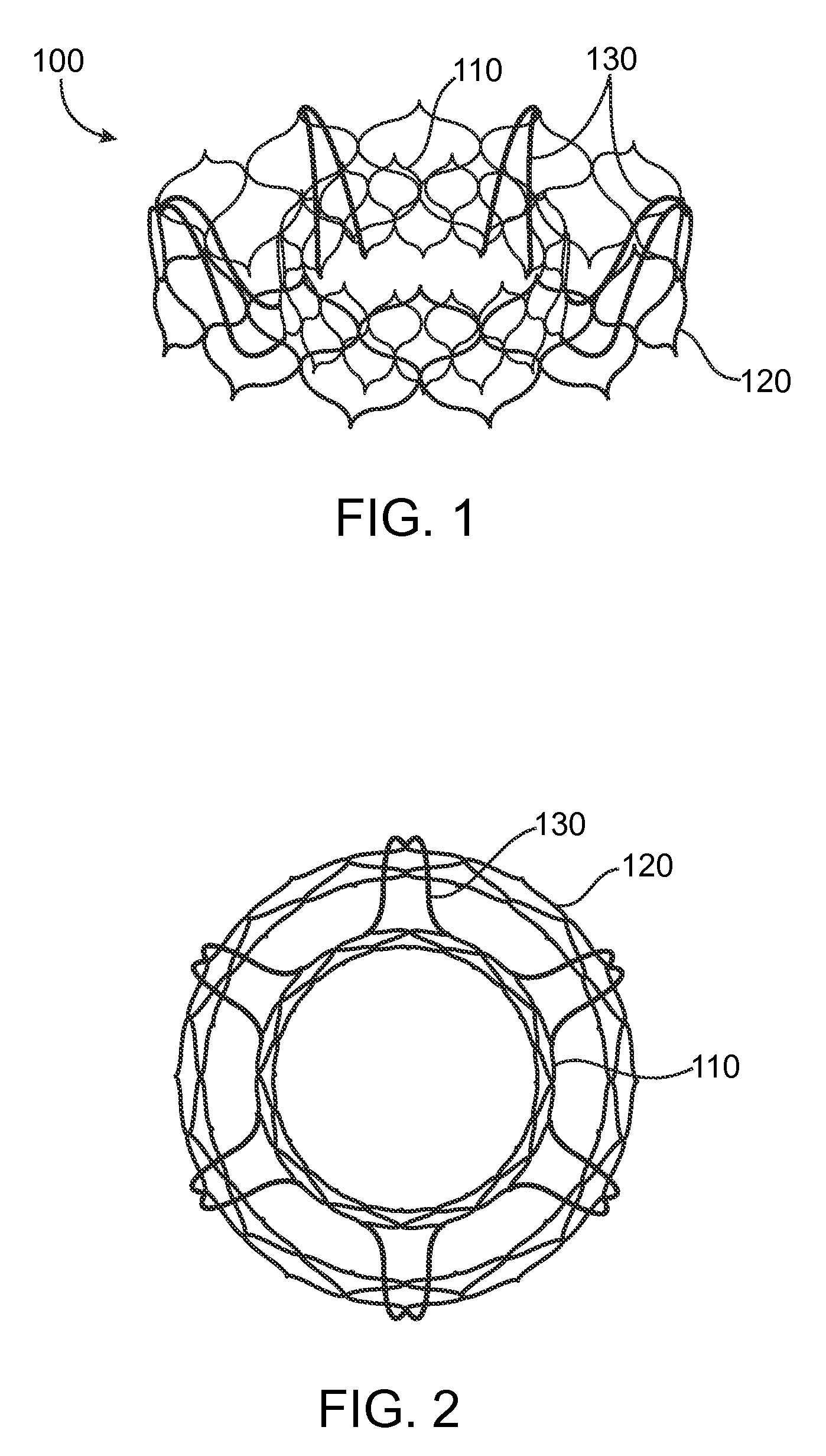 Valve prosthesis and method for delivery