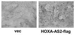 Application of long chain non-coded RNA-HOXA-AS2 in bone tissue damage repair