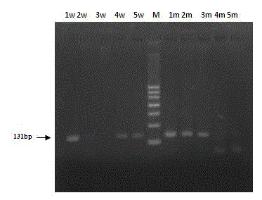 Molecule diagnosis method for detecting sheep high fecundity gene BMPR1B