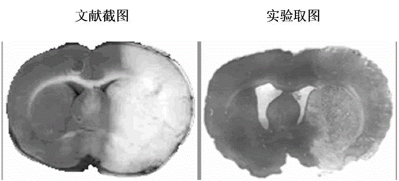 Preparation method of permanent middle cerebral artery occlusion model