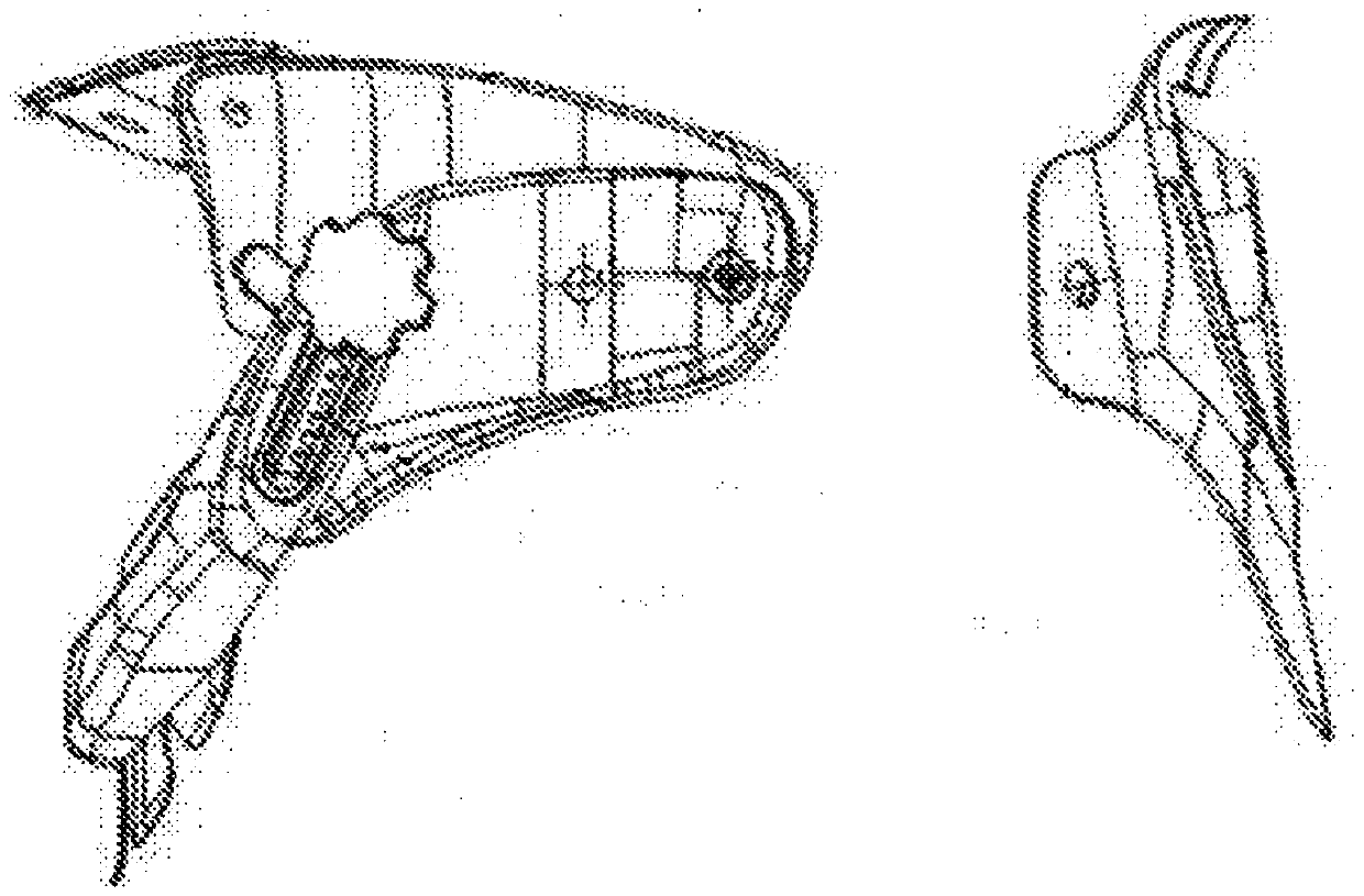 Double-sided adjustable cervical vertebra tractor