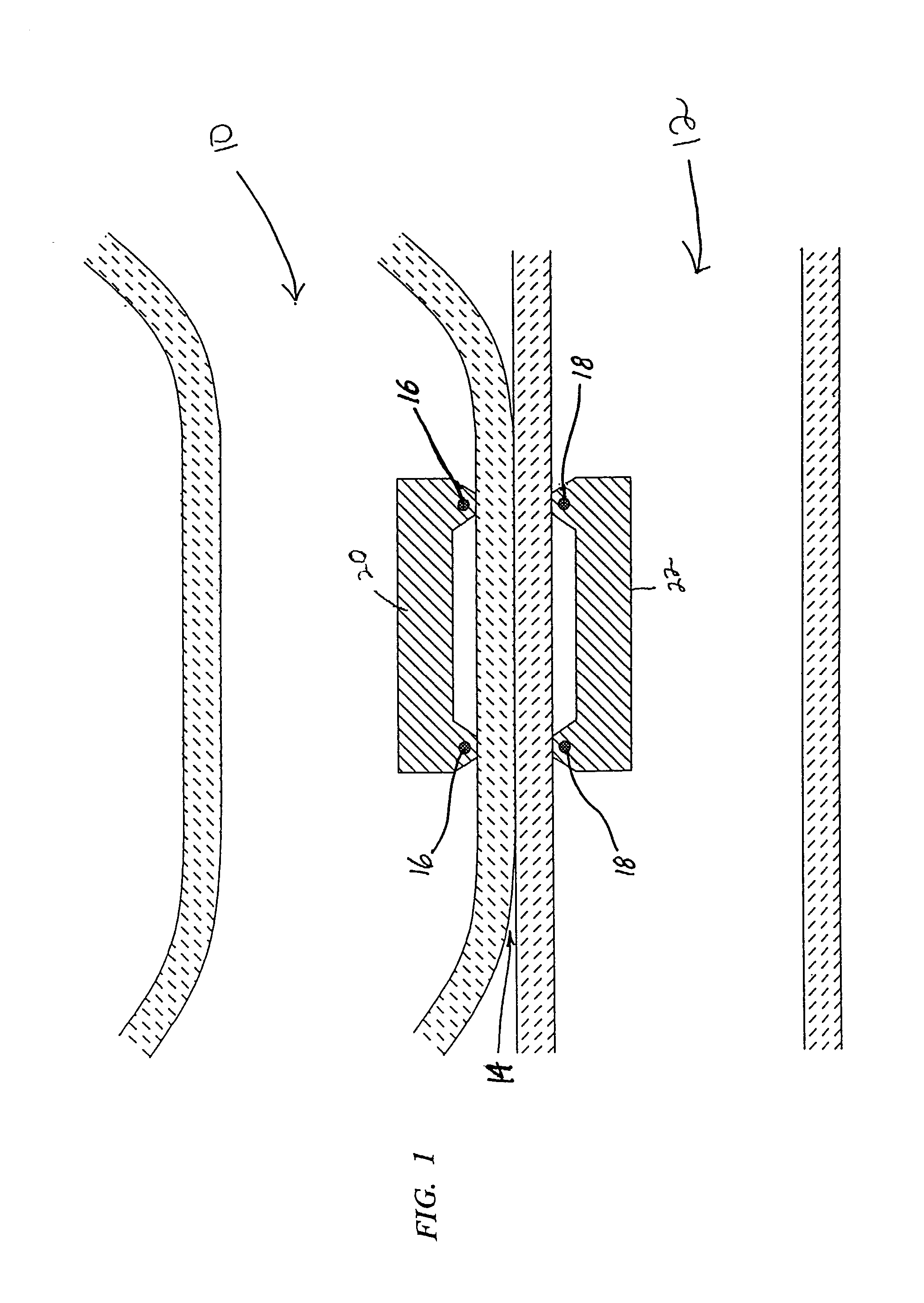 Anastomosis system and related Methods