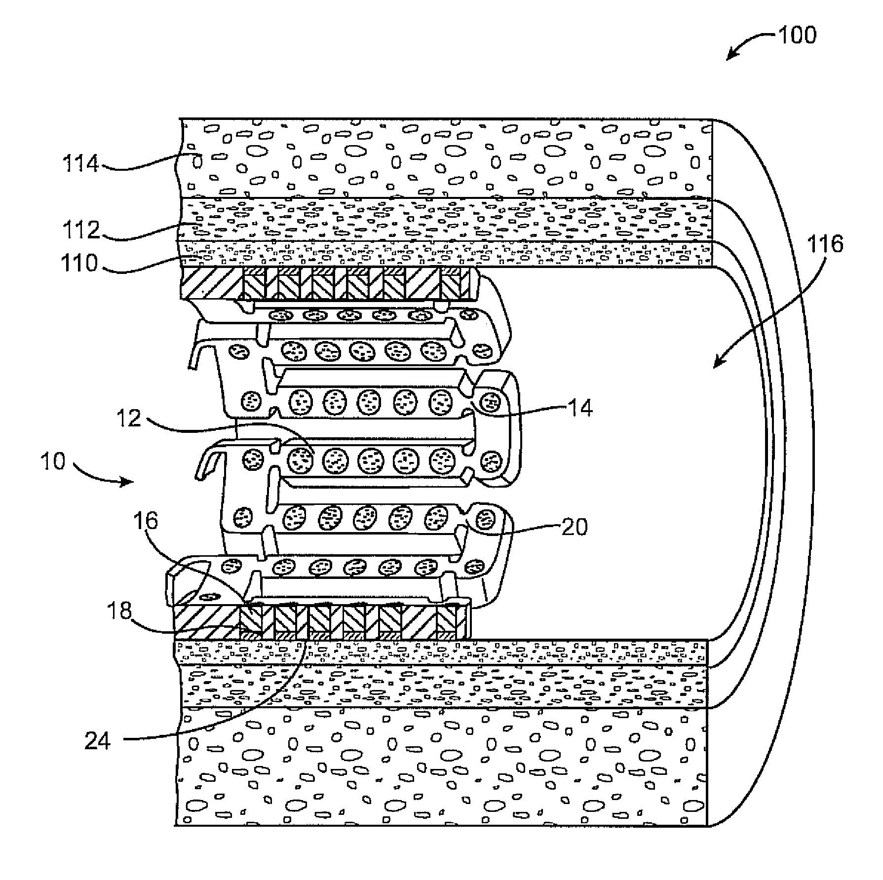 Methods and Devices for Reducing Tissue Damage After Ischemic Injury