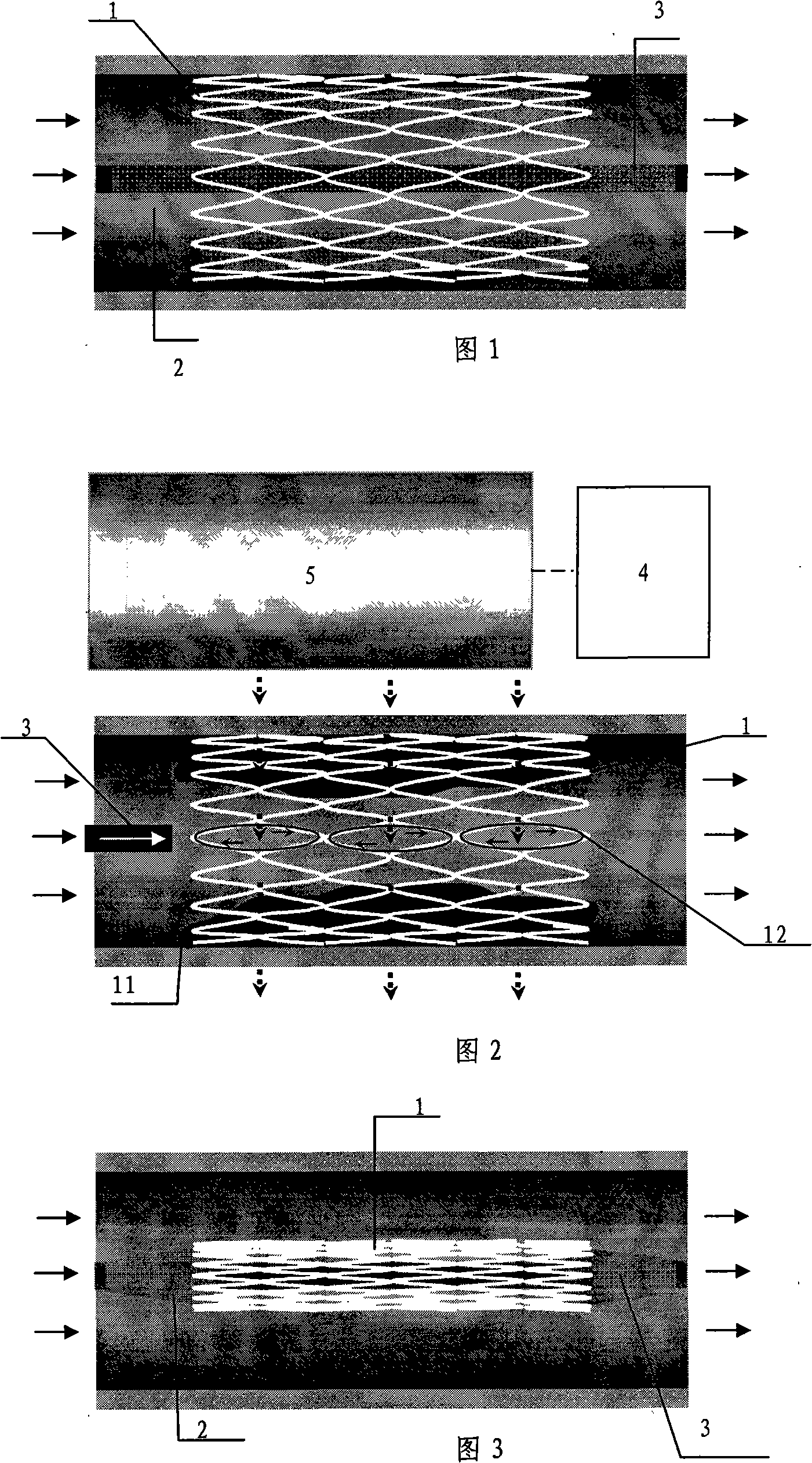 Apparatus for taking out metal stent in vascular or non-vascular cavity channel