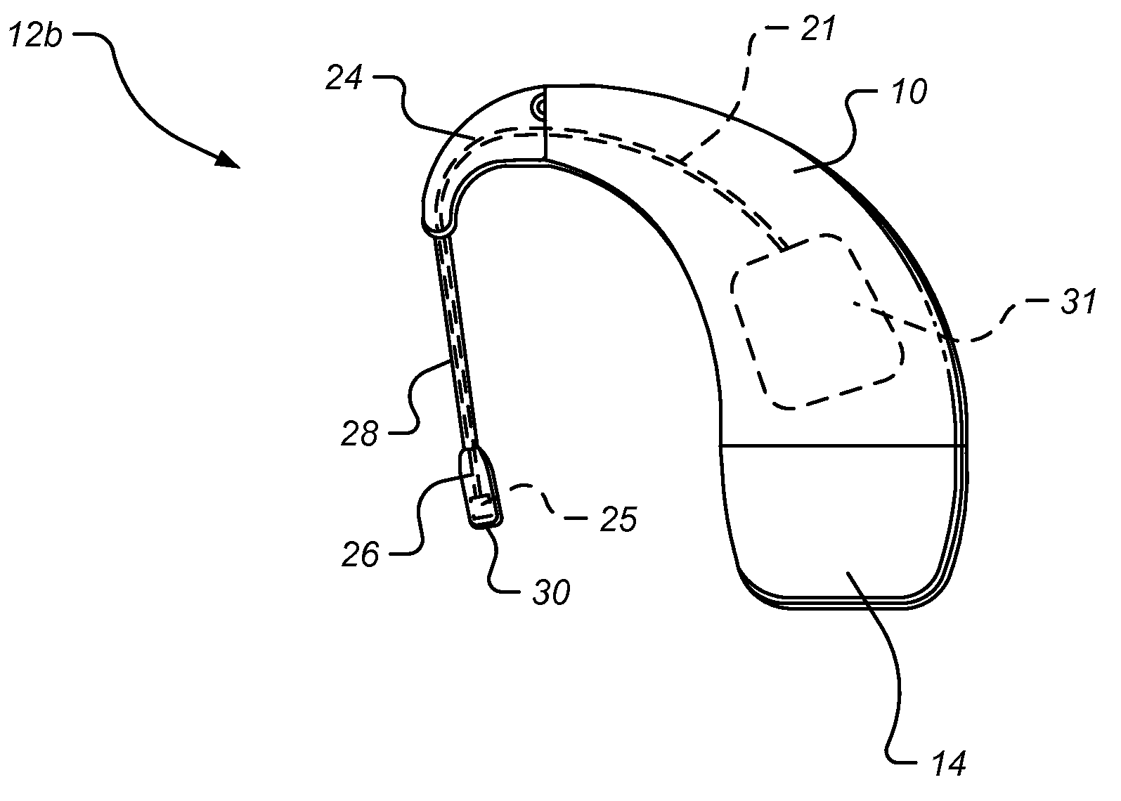 Accessory Adapter For Cochlear Implant System Providing Simultaneous T-Mic and External Audio Input