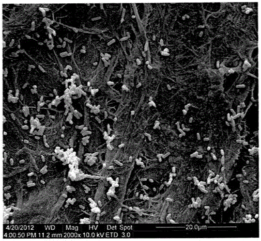 A method of adding microbial flocculant to improve the dewatering performance of activated sludge