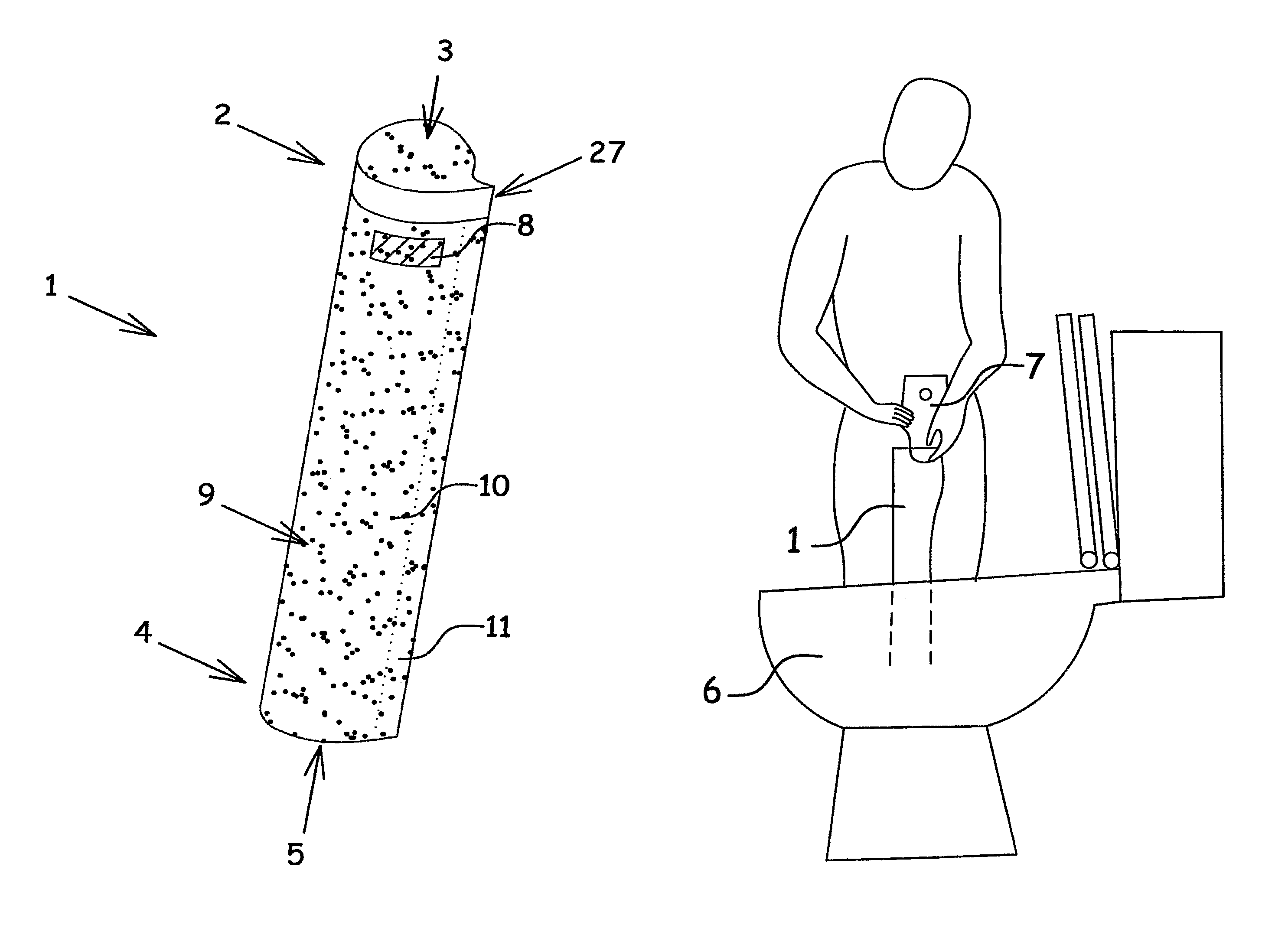 Disposable ostomy irrigation sleeve