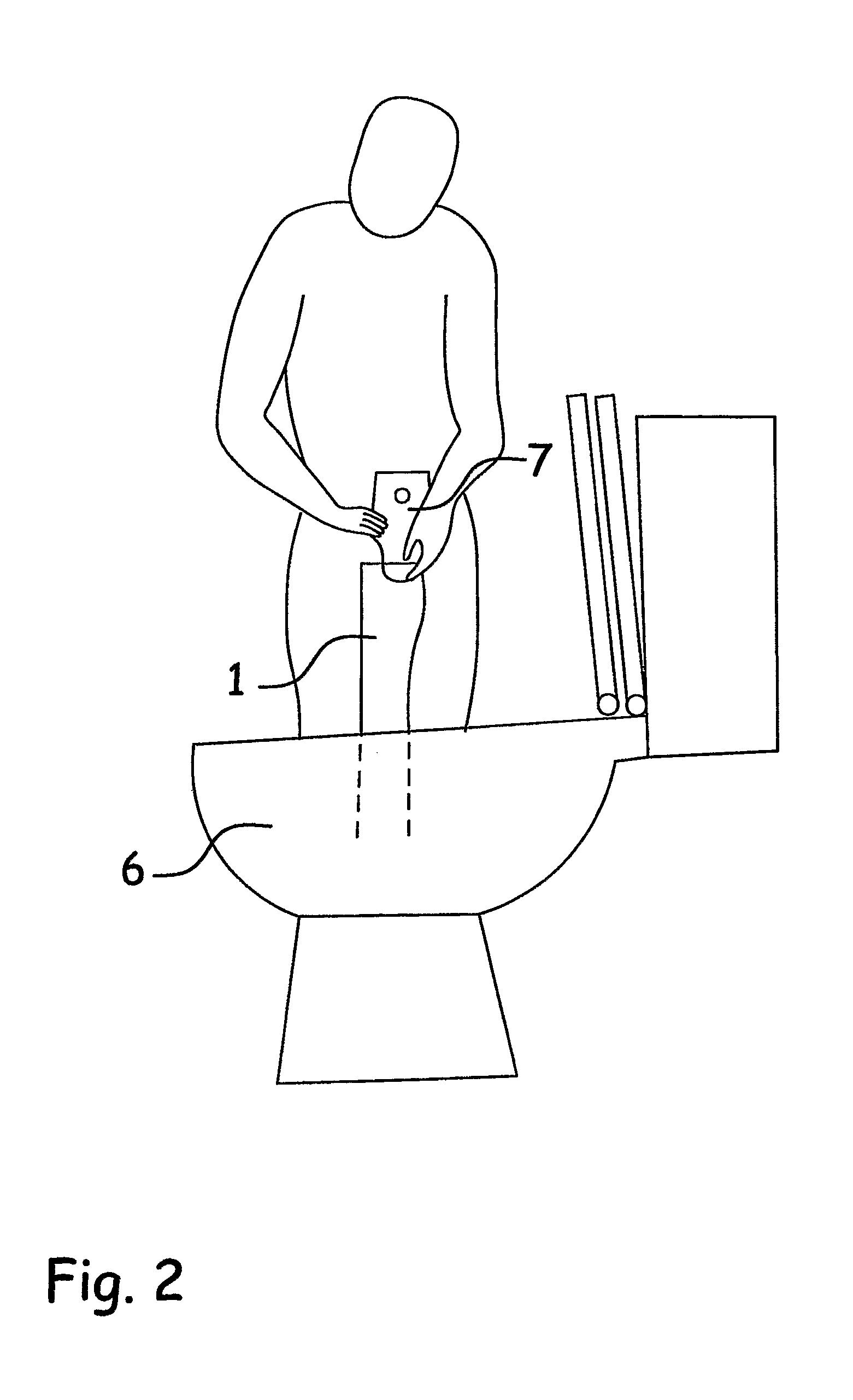 Disposable ostomy irrigation sleeve