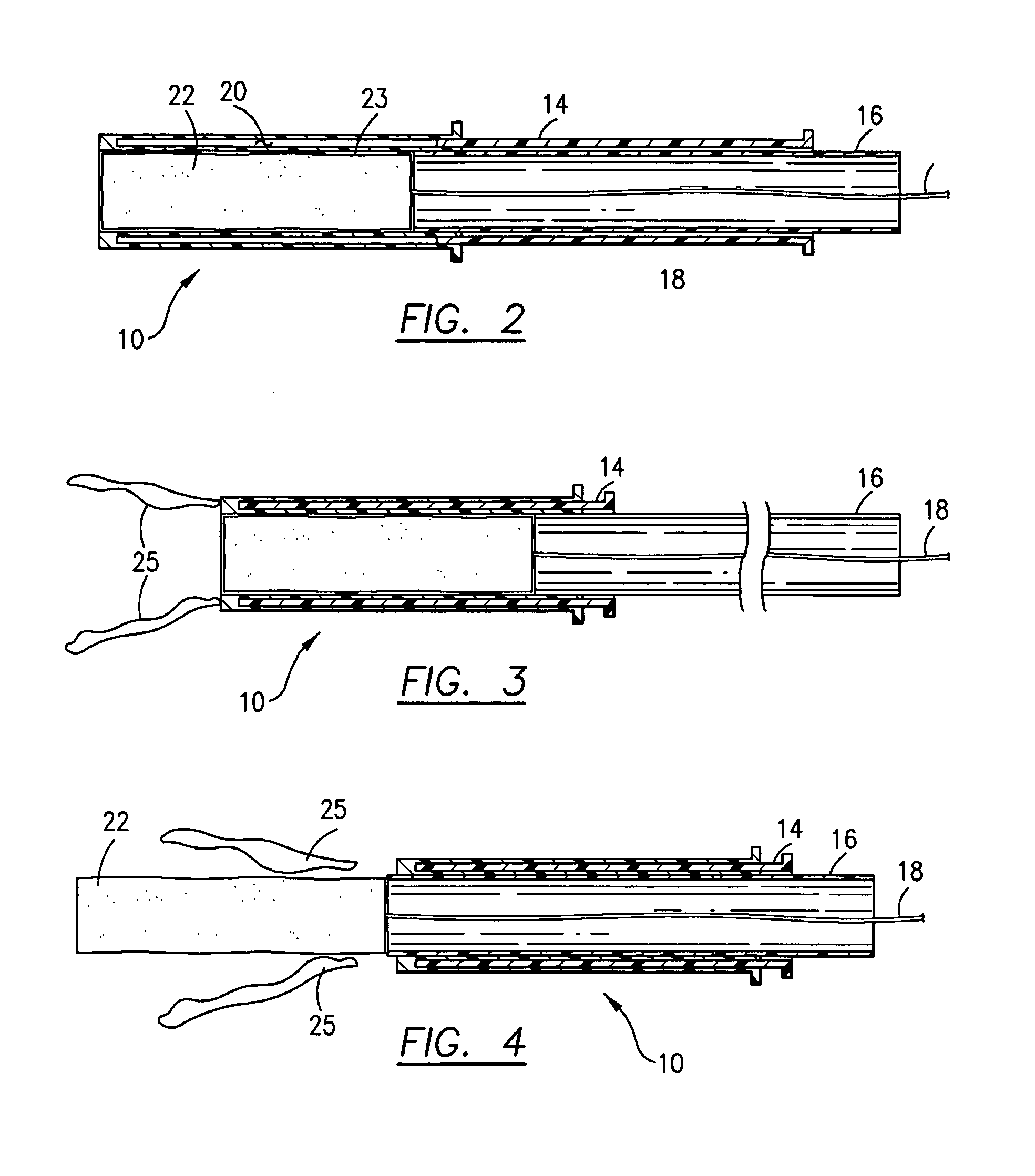 Apparatus and method for the treatment of dysmenorrhea