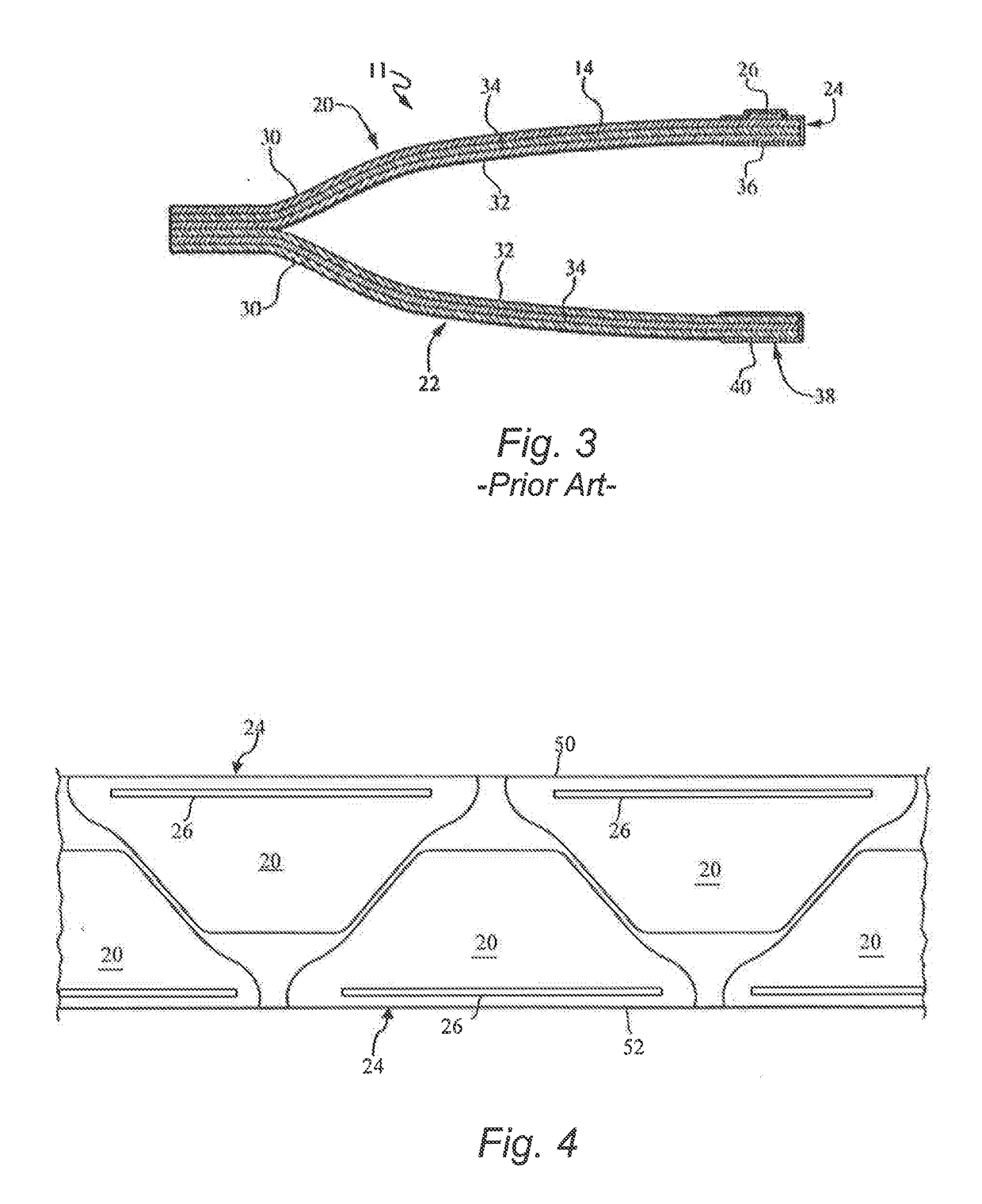 Method and System for Splicing Nose Wire in a Facemask Manufacturing Process