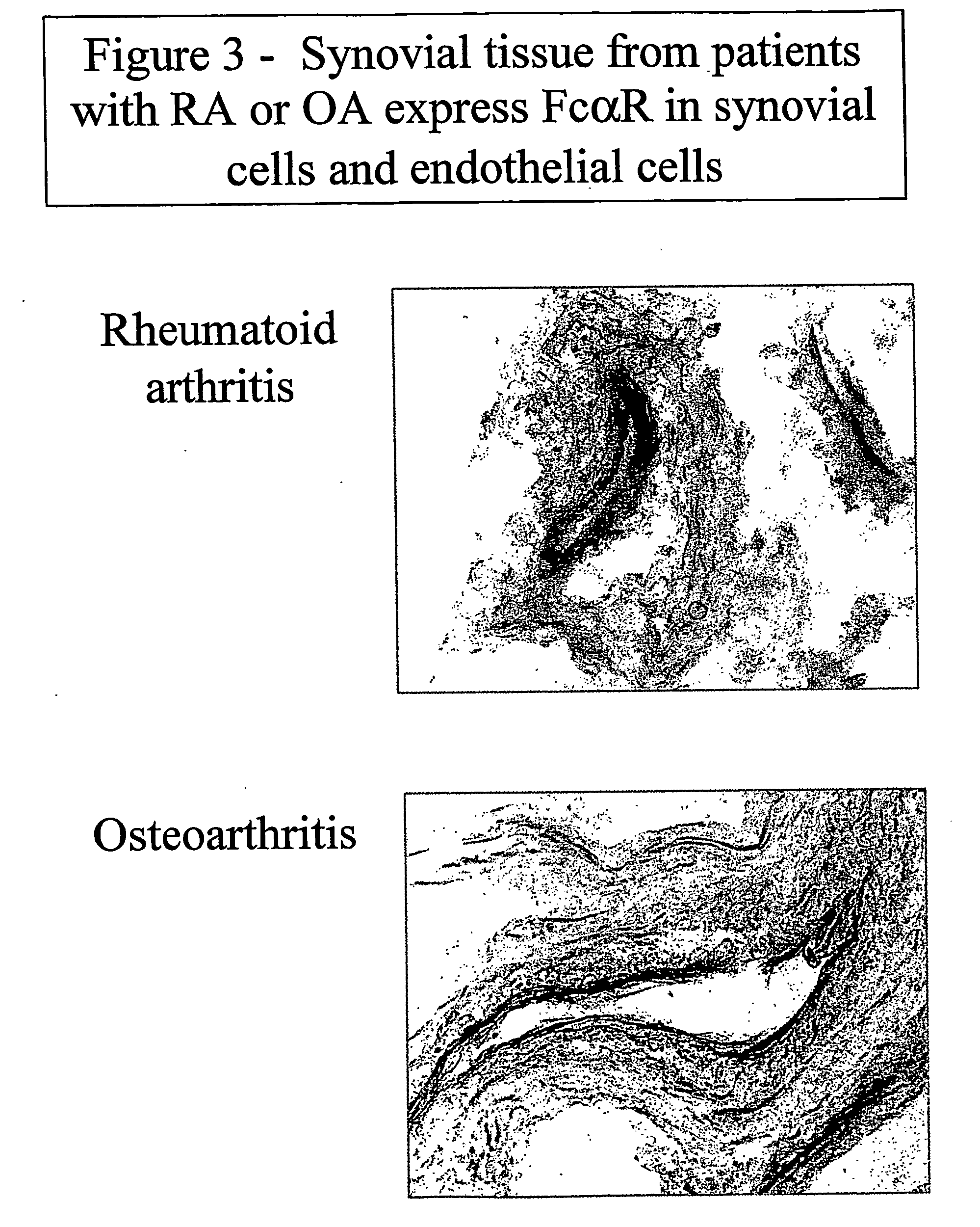 Modulation of mesenchymal cells via iga-receptors