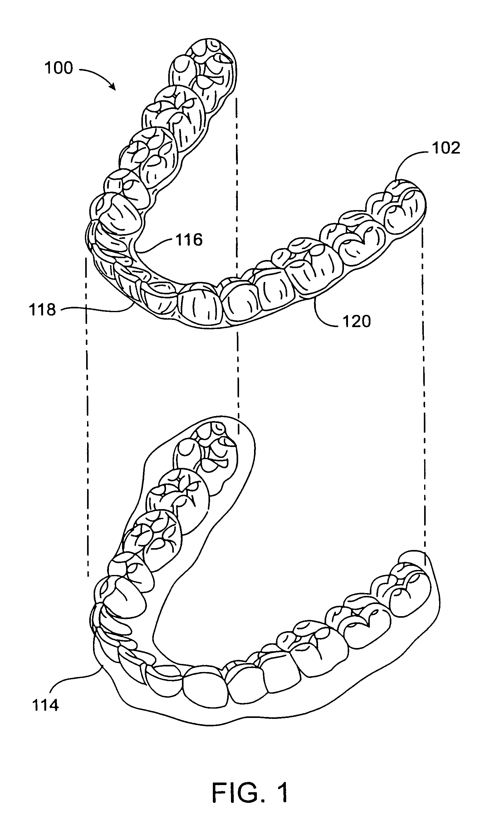 Tooth positioning appliances and systems
