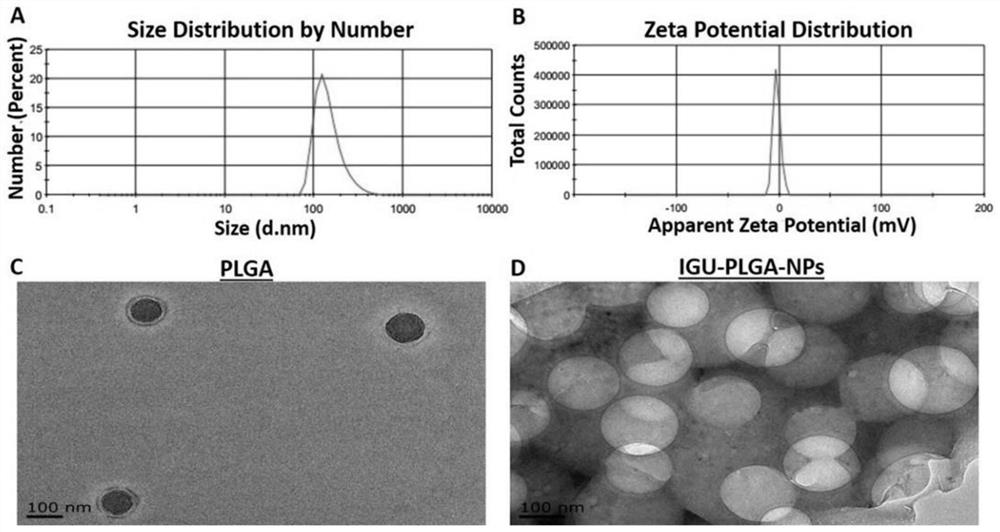 Igu-plga-nps nanoparticle and its preparation method and application